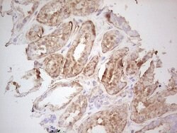 UBE2D2 Monoclonal Antibody (OTI1D11), TrueMAB , OriGene 100 &mu;L; Unconjugated:Antibodies,
