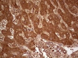 UBE2D2 Monoclonal Antibody (OTI1D11), TrueMAB , OriGene 100 &mu;L; Unconjugated:Antibodies,