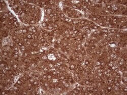 UBE2D2 Monoclonal Antibody (OTI1D11), TrueMAB , OriGene 100 &mu;L; Unconjugated:Antibodies,