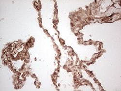 UBE2D2 Monoclonal Antibody (OTI1D11), TrueMAB , OriGene 100 &mu;L; Unconjugated:Antibodies,