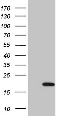 UBE2D2 Monoclonal Antibody (OTI1H4), TrueMAB , OriGene 100 &mu;L | Buy Online | OriGene | Fisher Scientific