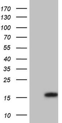 UBE2D2 Monoclonal Antibody (OTI1D11), TrueMAB , OriGene 100 &mu;L; Unconjugated:Antibodies,