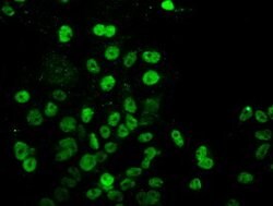 UBE2E3 Mouse anti-Human, Clone: OTI4C8, lyophilized, TrueMAB 100 &mu;g;