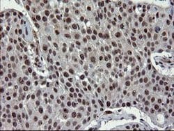 UBE2E3 Monoclonal Antibody (OTI1B4), TrueMAB , OriGene 100 &mu;L; Unconjugated:Antibodies,