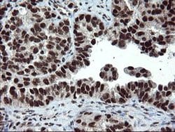 UBE2E3 Monoclonal Antibody (OTI1B4), TrueMAB , OriGene 100 &mu;L; Unconjugated:Antibodies,