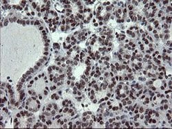 UBE2E3 Monoclonal Antibody (OTI1B4), TrueMAB , OriGene 100 &mu;L; Unconjugated:Antibodies,
