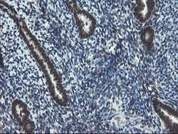 UBE2E3 Monoclonal Antibody (OTI1B4), TrueMAB , OriGene 100 &mu;L; Unconjugated:Antibodies,