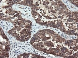 UBE2E3 Monoclonal Antibody (OTI6D3), TrueMAB , OriGene 100 &mu;L; Unconjugated:Antibodies,