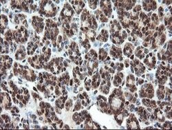 UBE2E3 Monoclonal Antibody (OTI6D3), TrueMAB , OriGene 100 &mu;L; Unconjugated:Antibodies,