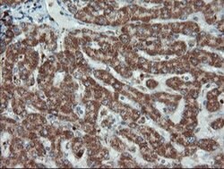 UBE2E3 Monoclonal Antibody (OTI6D3), TrueMAB , OriGene:Antibodies:Primary