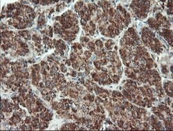 UBE2E3 Monoclonal Antibody (OTI6D3), TrueMAB , OriGene 100 &mu;L; Unconjugated:Antibodies,
