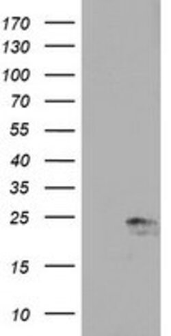 UBE2E3 Mouse anti-Human, Clone: OTI1B5, lyophilized, TrueMAB 100 &mu;g;