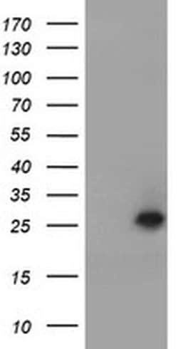 UBE2E3 Monoclonal Antibody (OTI1D12), TrueMAB , OriGene 30 &mu;L; Unconjugated:Antibodies,