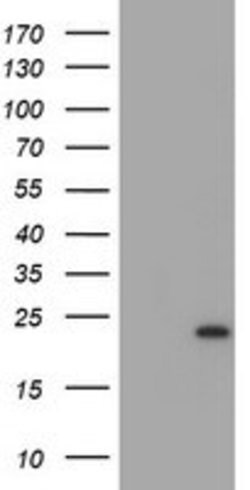 UBE2E3 Mouse anti-Human, Clone: OTI2B1, lyophilized, TrueMAB 100 &mu;g;