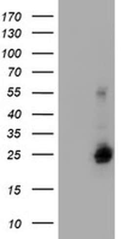 UBE2E3 Monoclonal Antibody (OTI1D10), TrueMAB , OriGene 30 &mu;L; Unconjugated:Antibodies,