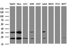 UBE2E3 Mouse anti-Human, Mouse, Clone: OTI1A3, lyophilized, TrueMAB 100 &mu;g | Buy Online | Origene Technologies | Fisher Scientific