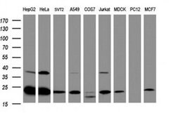 UBE2E3 Monoclonal Antibody (OTI1C3), TrueMAB , OriGene 100 &mu;L; Unconjugated:Antibodies,