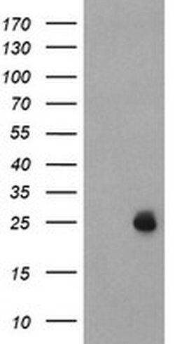 UBE2E3 Monoclonal Antibody (OTI4G4), TrueMAB , OriGene 30 &mu;L; Unconjugated:Antibodies,
