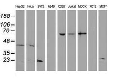 UBE2E3 Mouse anti-Human, Mouse, Clone: OTI4G4, lyophilized, TrueMAB 100
