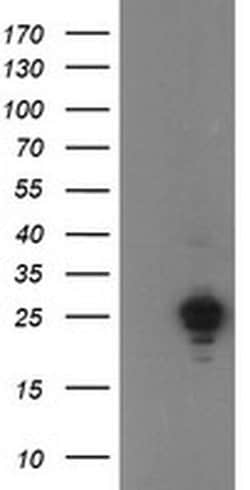UBE2E3 Monoclonal Antibody (OTI3E5), TrueMAB , OriGene:Antibodies:Primary