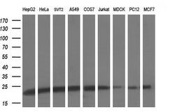 UBE2E3 Mouse anti-Human, Clone: OTI3E5, lyophilized, TrueMAB 100 &mu;g;