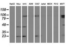 UBE2E3 Mouse anti-Human, Clone: OTI4C8, lyophilized, TrueMAB 100 &mu;g;
