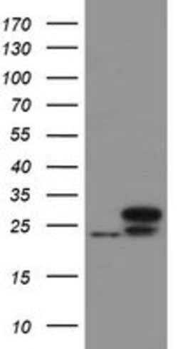 UBE2E3 Mouse anti-Human, Clone: OTI3B7, lyophilized, TrueMAB 100 &mu;g;