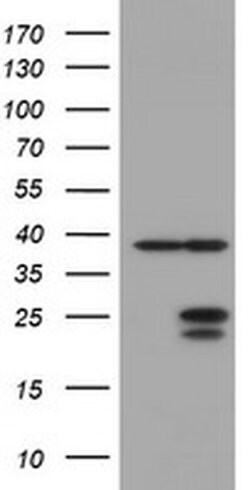 UBE2E3 Monoclonal Antibody (OTI2E5), TrueMAB , OriGene 100 &mu;L; Unconjugated:Antibodies,