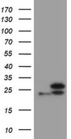 UBE2E3 Monoclonal Antibody (OTI3F7), TrueMAB , OriGene:Antibodies:Primary
