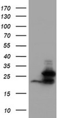 UBE2E3 Monoclonal Antibody (OTI2C7), TrueMAB , OriGene:Antibodies:Primary