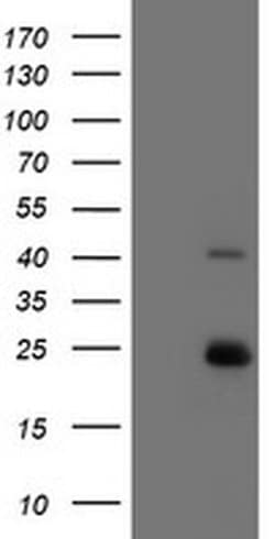 UBE2E3 Monoclonal Antibody (OTI6D3), TrueMAB , OriGene 100 &mu;L; Unconjugated:Antibodies,
