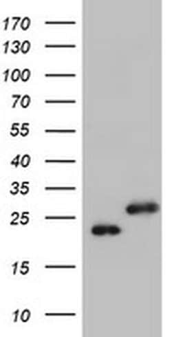 UBE2E3 Monoclonal Antibody (OTI6D10), TrueMAB , OriGene 100 &mu;L; Unconjugated:Antibodies,