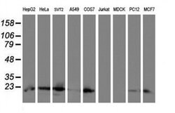 UBE2E3 Monoclonal Antibody (OTI6D10), TrueMAB , OriGene:Antibodies:Primary