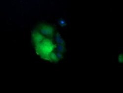UBE2G2 Monoclonal Antibody (OTI5F1), TrueMAB , OriGene 100 &mu;L; Unconjugated:Antibodies,