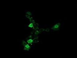 UBE2G2 Monoclonal Antibody (OTI9F2), TrueMAB , OriGene 100 &mu;L; Unconjugated:Antibodies,