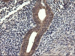 UBE2G2 Monoclonal Antibody (OTI5F1), TrueMAB , OriGene 100 &mu;L; Unconjugated:Antibodies,