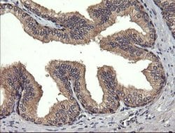 UBE2G2 Monoclonal Antibody (OTI5F1), TrueMAB , OriGene:Antibodies:Primary