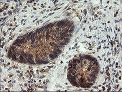 UBE2G2 Monoclonal Antibody (OTI5F1), TrueMAB , OriGene 100 &mu;L; Unconjugated:Antibodies,