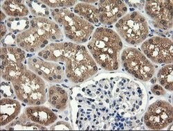 UBE2G2 Monoclonal Antibody (OTI5F1), TrueMAB , OriGene 100 &mu;L; Unconjugated:Antibodies,
