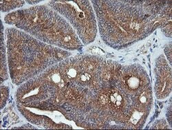 UBE2G2 Monoclonal Antibody (OTI1D7), TrueMAB , OriGene 30 &mu;L; Unconjugated:Antibodies,