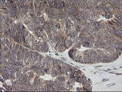 UBE2G2 Monoclonal Antibody (OTI1B10), TrueMAB , OriGene:Antibodies:Primary