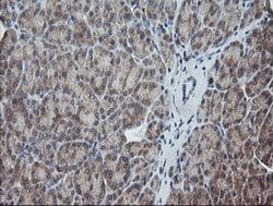 UBE2G2 Monoclonal Antibody (OTI1B10), TrueMAB , OriGene 30 &mu;L; Unconjugated:Antibodies,