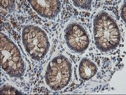 UBE2G2 Monoclonal Antibody (OTI1B10), TrueMAB , OriGene 30 &mu;L; Unconjugated:Antibodies,