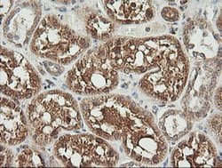 UBE2G2 Monoclonal Antibody (OTI1B10), TrueMAB , OriGene 30 &mu;L; Unconjugated:Antibodies,
