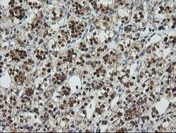 UBE2G2 Monoclonal Antibody (OTI1B10), TrueMAB , OriGene 30 &mu;L; Unconjugated:Antibodies,