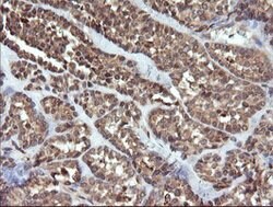UBE2G2 Mouse anti-Canine, Human, Mouse, Rat, Clone: OTI1D2, lyophilized,