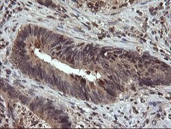 UBE2G2 Mouse anti-Canine, Human, Mouse, Rat, Clone: OTI1D2, lyophilized,