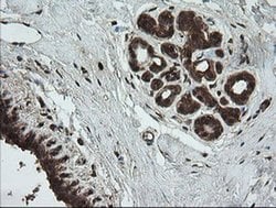 UBE2G2 Monoclonal Antibody (OTI9F2), TrueMAB , OriGene 100 &mu;L; Unconjugated:Antibodies,