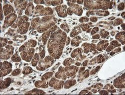 UBE2G2 Monoclonal Antibody (OTI9F2), TrueMAB , OriGene 100 &mu;L; Unconjugated:Antibodies,