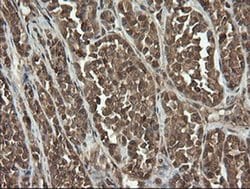 UBE2G2 Monoclonal Antibody (OTI9F2), TrueMAB , OriGene 100 &mu;L; Unconjugated:Antibodies,